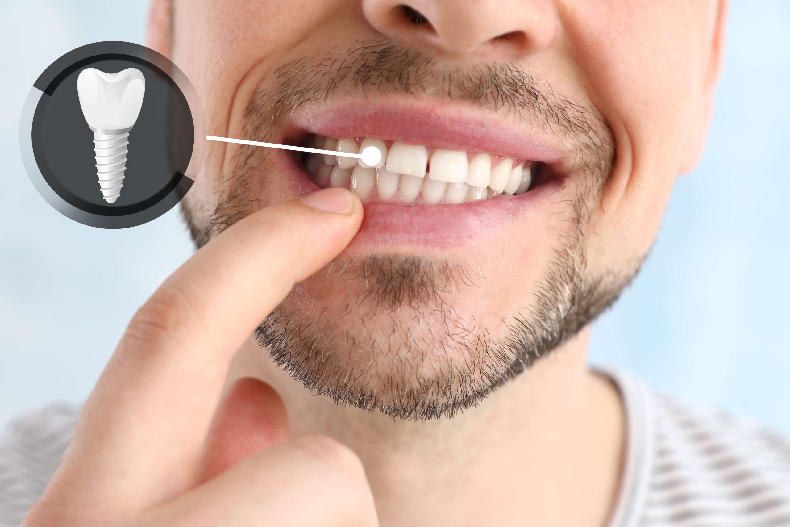 Your Trusted Dentist in Chaska, MN for Complete Family Dental Care